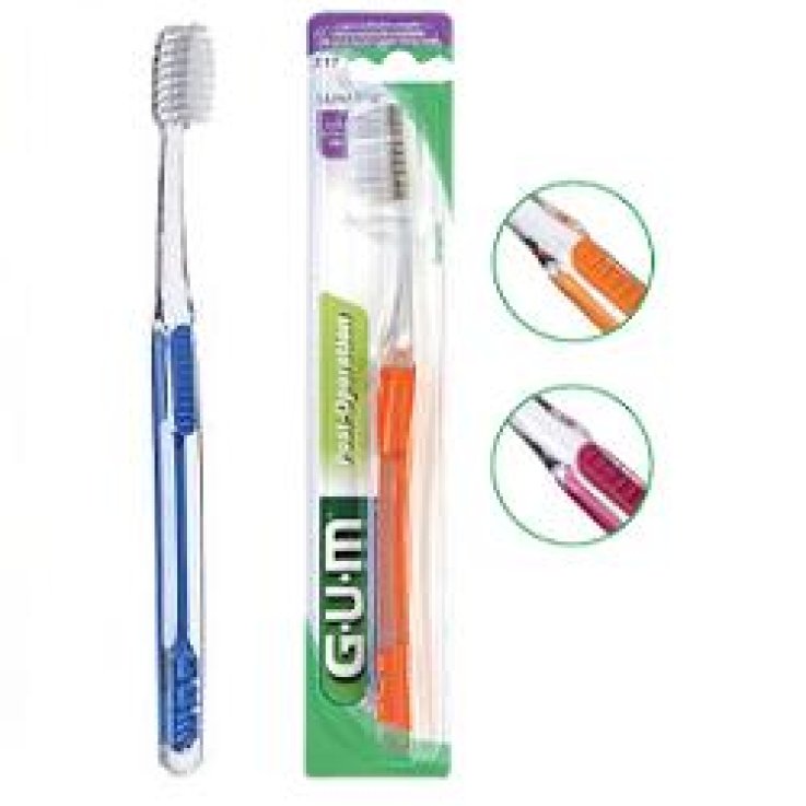 BUTLER Spaz.PostOp.Delicat.317 BUTLER Spaz.PostOp.Delicat.317