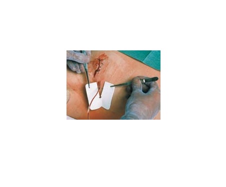 MEDICAZIONE PER TUBI DI DRENAGGIO FESSURATA METALLINE DRAIN 6X7CM FORO 4,5X11MM 50 PEZZI - Farmapanda Srl